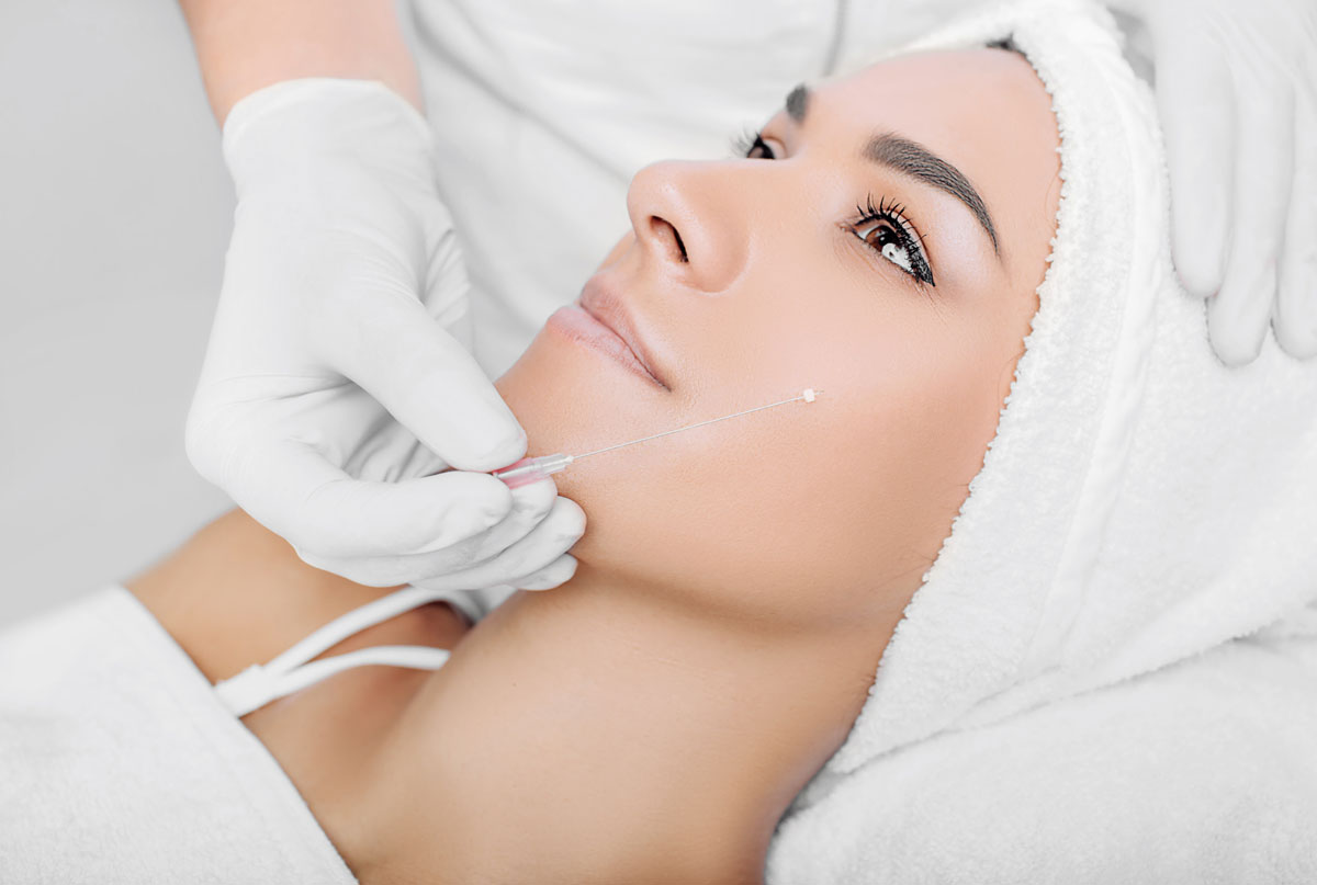 Fadenlifting Vorher-Nachher – Amenta Cosmetic Karlsruhe